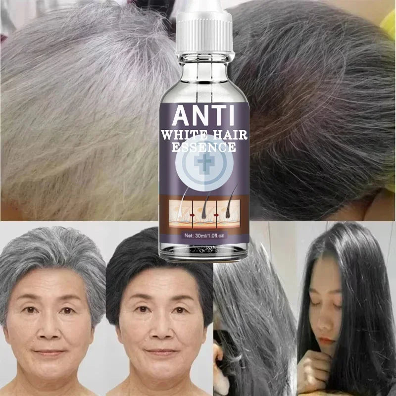 White Hair Remover – Restore Natural Hair Color in 7 Days, Gray Hair Treatment Solution
