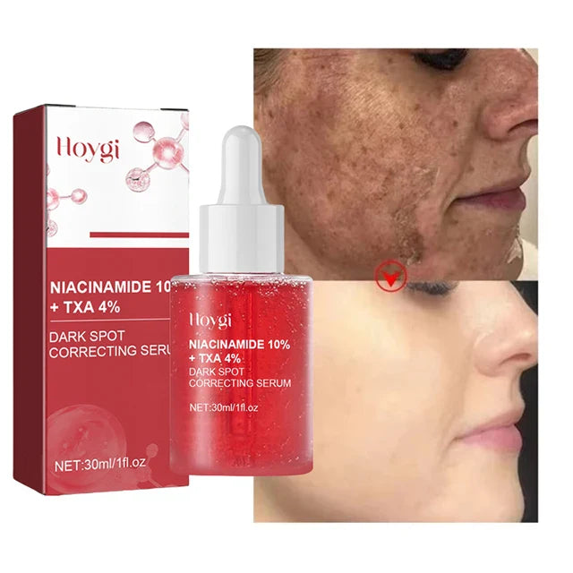 Niacinamide Serum – Dark Spot Correcting, Moisturizing & Brightening, Fades Fine Lines, Deep Cleansing Korean Skincare