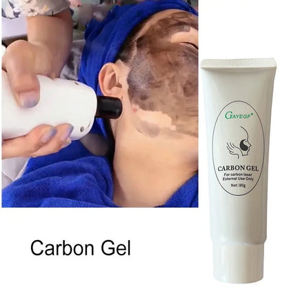Carbon Cream Black Gel for ND YAG Laser – Skin Peeling, Rejuvenation, Whitening & Deep Cleansing Face Cream