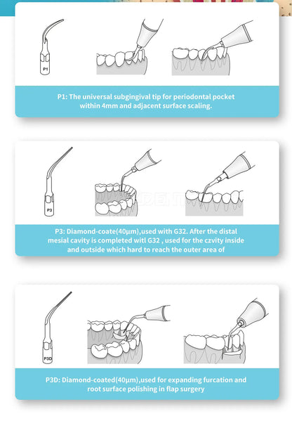 AZDENT 5pcs Dental Scaler Tips – Compatible with EMS, WOODPECKER, SATELEC, DTE, NSK Ultrasonic Scalers
