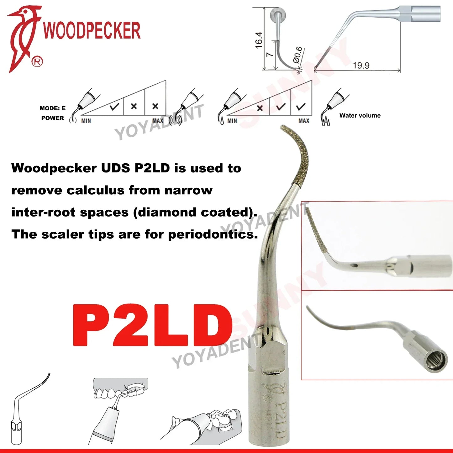 Woodpecker Dental Scaler Tips – Ultrasonic Tooth Cleaning, Endo & Perio Scaling Tips, Fit EMS UDS Scaler Handpiece