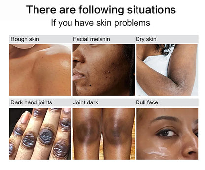 AILKE Glutathione Lightening Body Lotion – Moisturizing & Hydrating for Even Skin Tone and Dark Spot Improvement