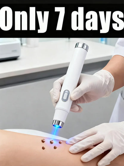 Blue Light Wart Removal Skin Care Tool – Easy Clean Portable Device for Gentle Skin Treatment & Wart Care Home Use