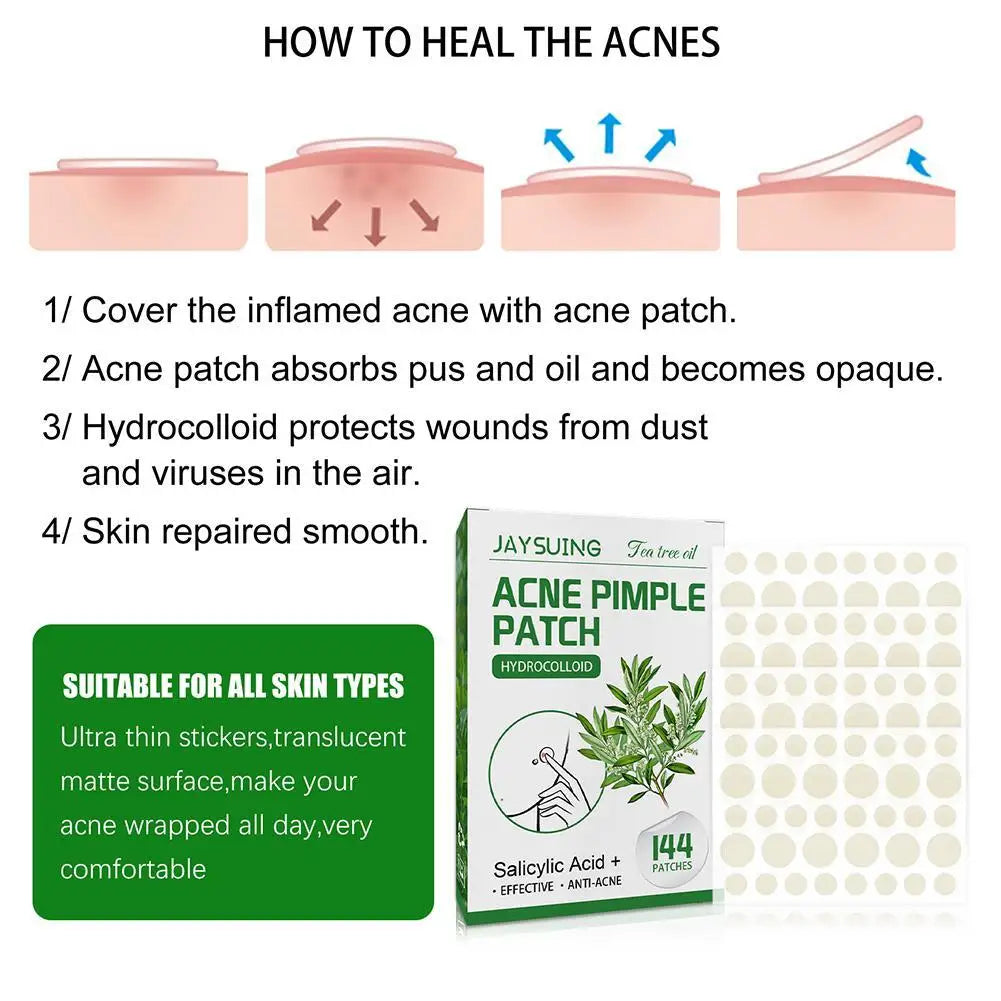 144 Pack Acne Pimple Patches – Translucent Matte Hydrocolloid with Salicylic Acid & Tea Tree Oil for Whiteheads & Inflamed Acne