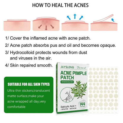 144 Pack Acne Pimple Patches – Translucent Matte Hydrocolloid with Salicylic Acid & Tea Tree Oil for Whiteheads & Inflamed Acne