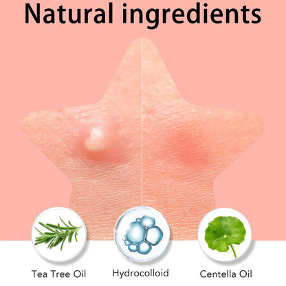 Pimple Patches - Salicylic Acid & Tea Tree Oil Acne Stickers