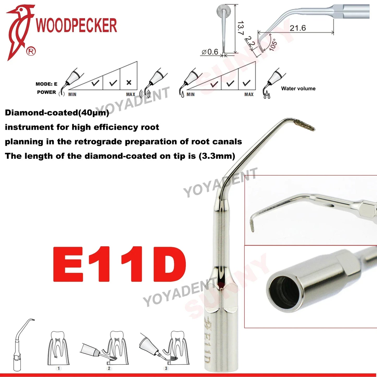 Woodpecker Dental Scaler Tips – Ultrasonic Tooth Cleaning, Endo & Perio Scaling Tips, Fit EMS UDS Scaler Handpiece