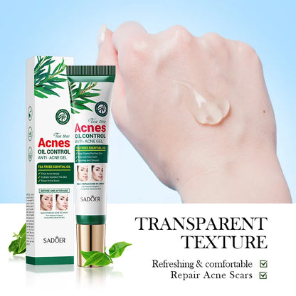 SADOER Tea Tree Acne Cream – Oil Control, Hydrating & Moisturizing Facial Skincare Gel
