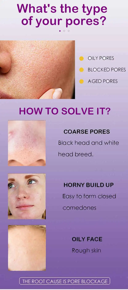 Pore Shrinking Serum – Facial Essence for Large Pore Removal, Tightening, Repairing, and Firming Skin Care