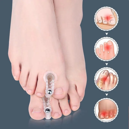 Bunion Toe Correctors - 2-Piece Hallux Valgus Spacers for Toe Alignment & Foot Care