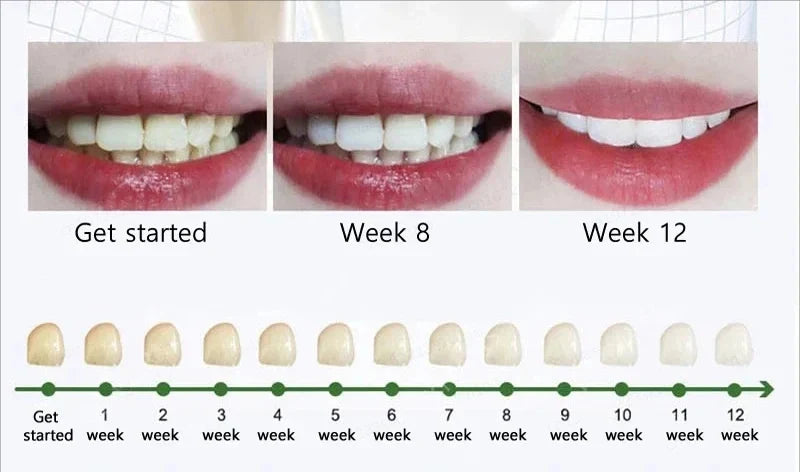 Cavity Removal & Gum Repair Oral Care – Clears Oral Bacteria for Healthy Gums