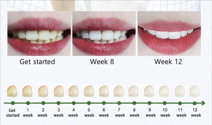 Cavity Removal & Gum Repair Oral Care – Clears Oral Bacteria for Healthy Gums