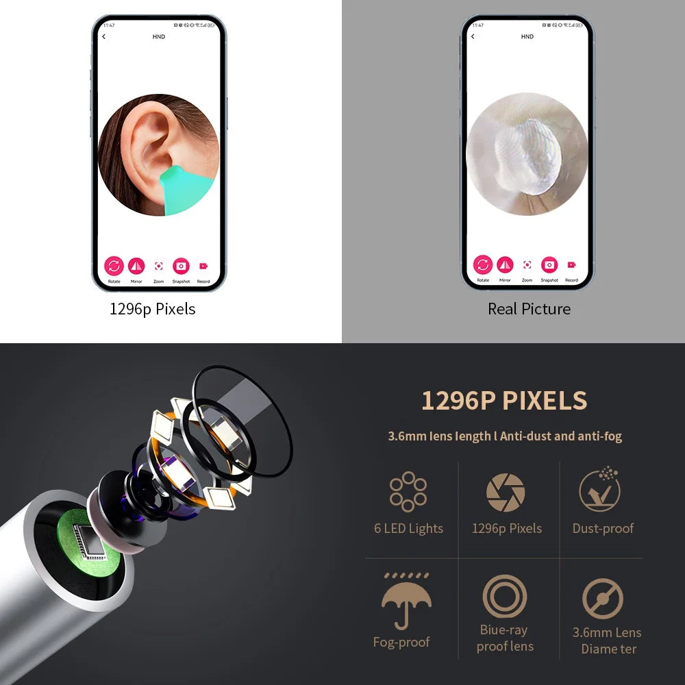 Smart Visual Ear Cleaner 1296P with Camera – USB-C Rechargeable Ear Wax Removal Tool, WiFi, 6 LED Lights