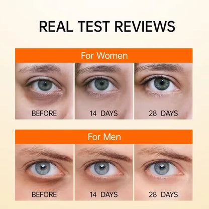Anti-Dark Circle Eye Serum — Retinol Oil for Wrinkle Removal, Firming, Eye Bag Reduction, Fine Line Fading & Brightening Korean Eye Care