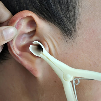 Plastic Ear Speculum - Smooth Professional Ear Care Tool for Earwax Removal & Examination