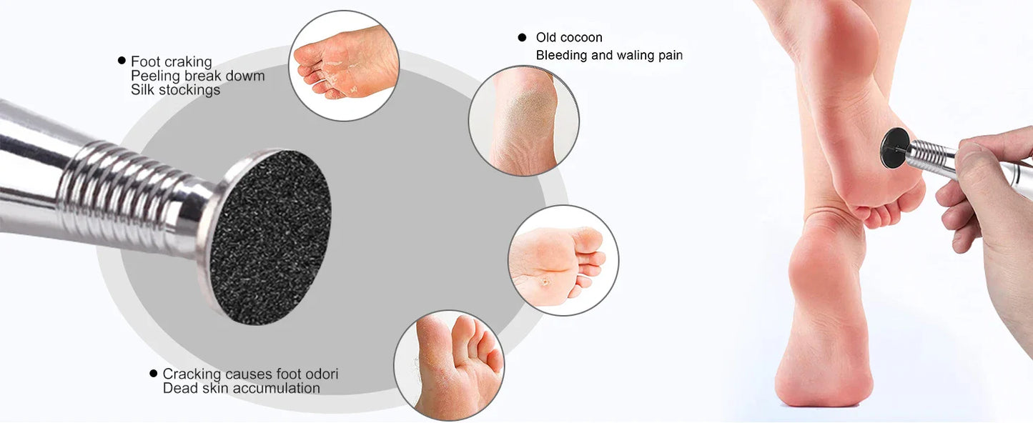100-Piece Pedicure Sanding Paper Set — Replaceable Foot Callus Removal Discs with 1 Pedicure Disk Pad
