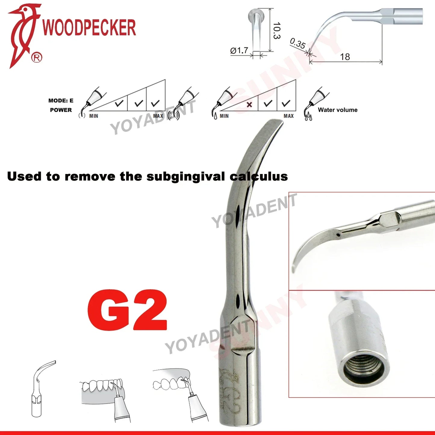 Woodpecker Dental Scaler Tips – Ultrasonic Tooth Cleaning, Endo & Perio Scaling Tips, Fit EMS UDS Scaler Handpiece