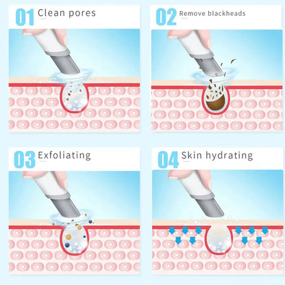 New Peeling Beauty Device – Small Bubble Oxygen Injection Hydra Dermabrasion Aqua Facial Cleaner for Blackhead Removal