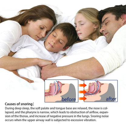 Mouth Tape Adhesive – Hypoallergenic Sleep Aid for Nose Breathing, Gentle Physical Sleep Mouth Tape 9M