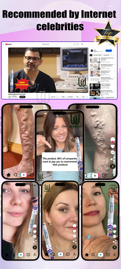 Varicose Vein & Spider Leg Pain Relief Treatment — Painless Care for Vasculitis & Phlebitis