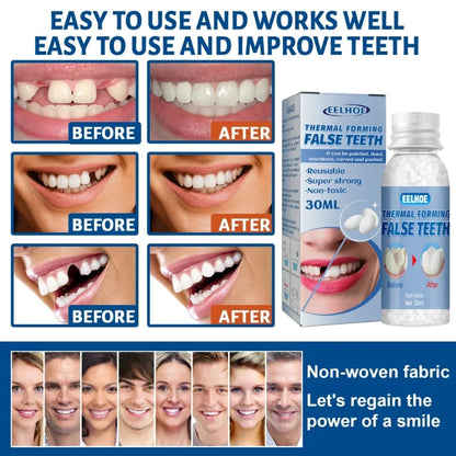 Resin Temporary Tooth Repair Glue – 10ml/20ml/30ml, Teeth Gaps & False Teeth Adhesive, Whitening Tooth Beauty Denture Repair