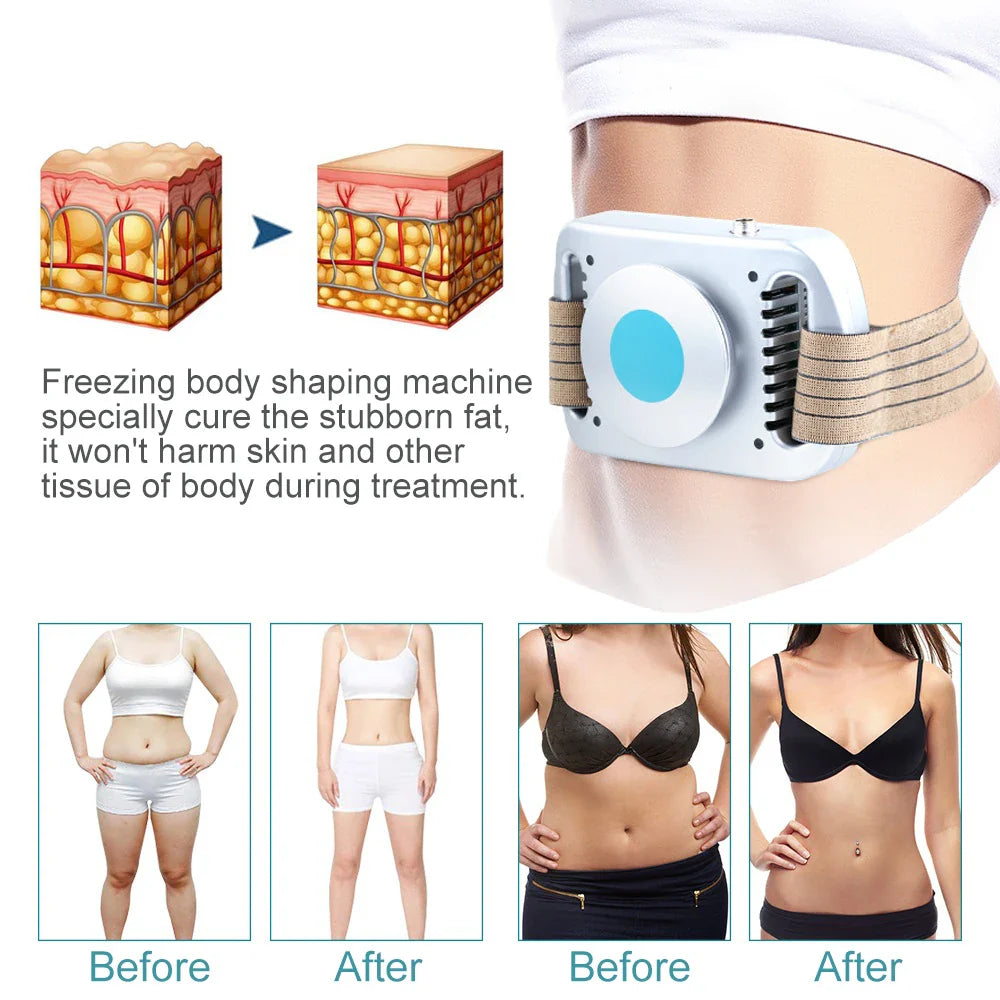 Cryolipolysis Fat Freezing Machine — Belly Fat Burner & Body Slimming Lipo Device for Women