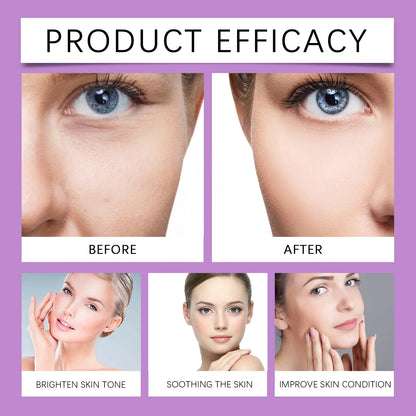 Peptide Whitening Face Cream – Anti-Melanin Dark Spot Corrector, Pigmentation Fading, Hydrating & Brightening Skin Smoothing Moisturizer