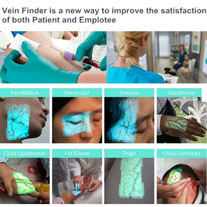QV500 Rechargeable Vein Finder – Portable Infrared Medical Viewer for Nursing, Visible Vein Detection