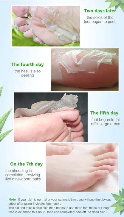Exfoliating Foot Mask & Pedicure Socks – Dead Skin Removal, Whitening Foot Care, Foot Spa Scrub & Skin Refreshment
