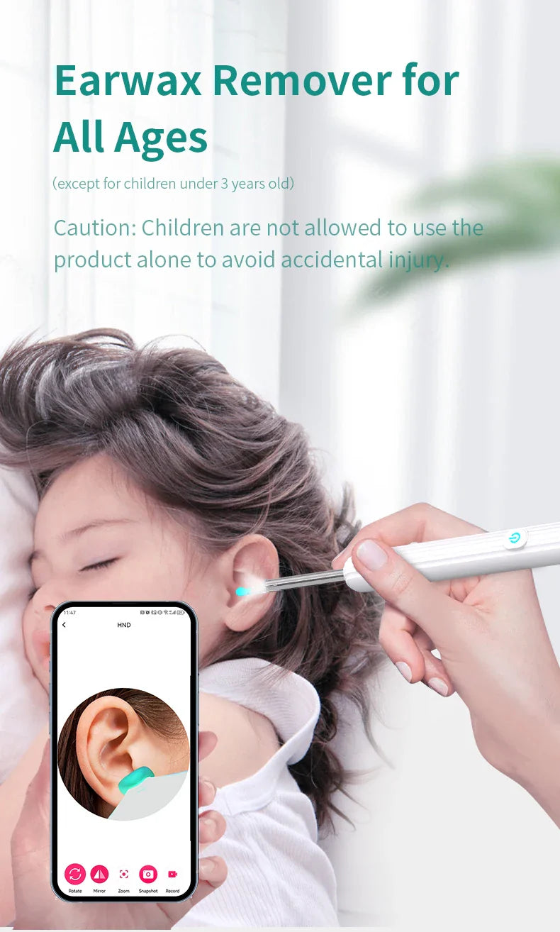 Smart Visual Ear Cleaner 1296P with Camera – USB-C Rechargeable Ear Wax Removal Tool, WiFi, 6 LED Lights