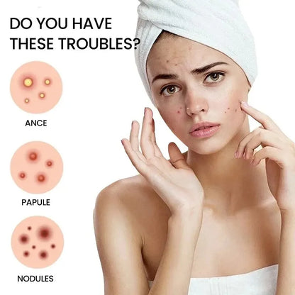 Acne Repair Patch - Facial Skin Care for Blemish & Pimple Marks, Acne Treatment & Pimple Repair Cover