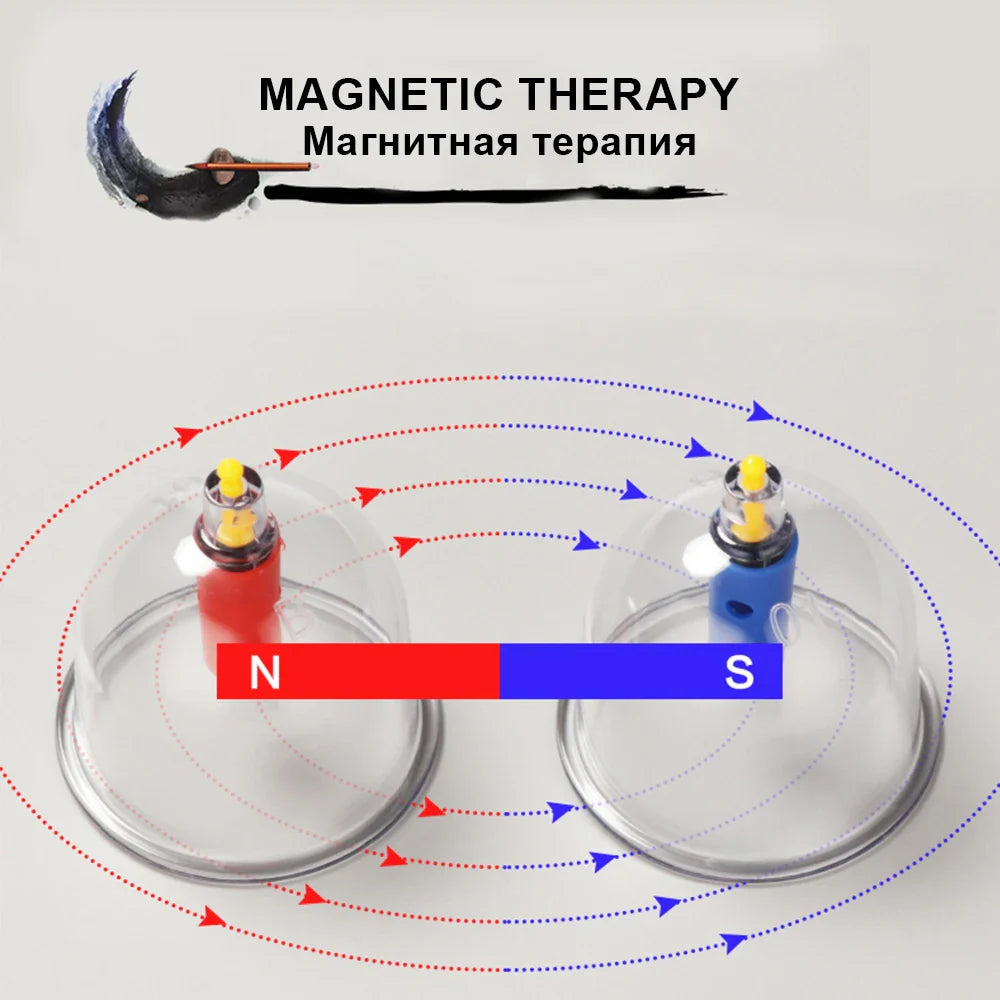 12/24-Cup Chinese Vacuum Cupping Therapy Set – Pull-Out Suction Massager for Pain Relief & Muscle Relaxation