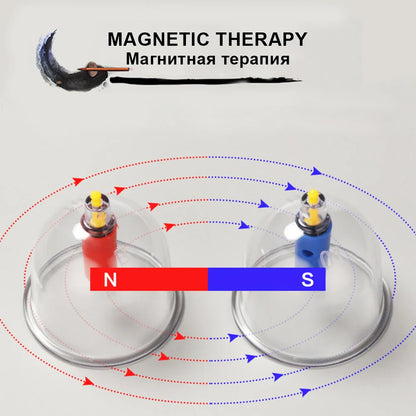 12/24-Cup Chinese Vacuum Cupping Therapy Set – Pull-Out Suction Massager for Pain Relief & Muscle Relaxation
