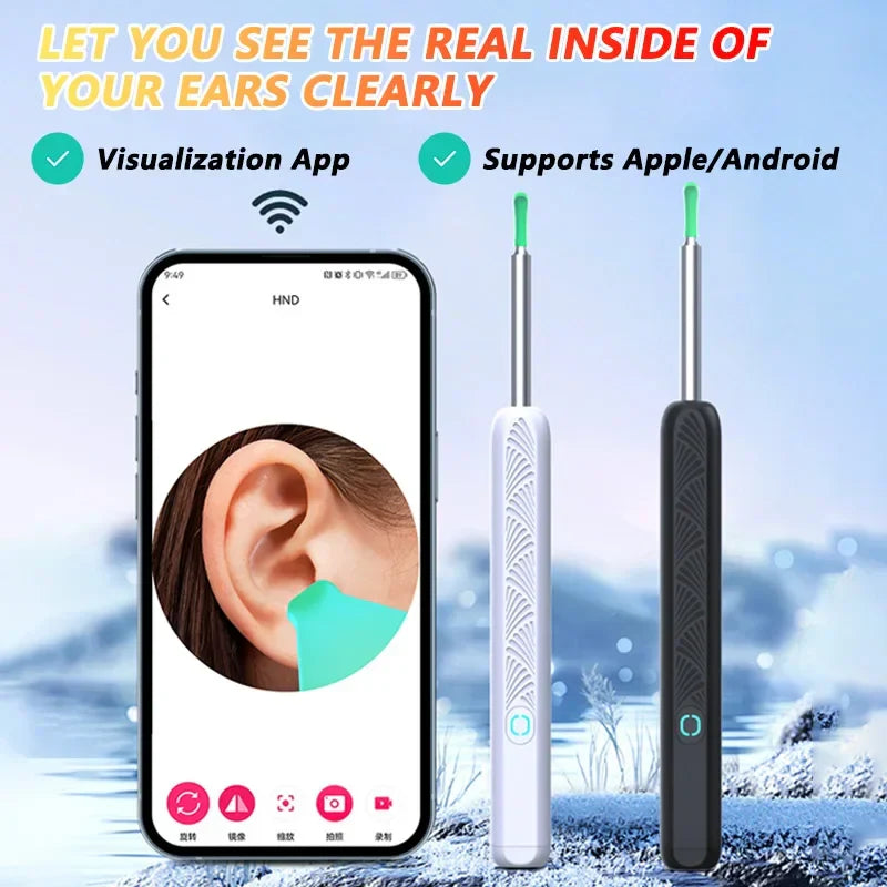 Visual Ear Wax Cleaner with Camera – Safe Luminous Otoscope Endoscope for Ear Cleaning & Ear Care