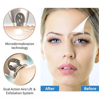 Wireless Diamond Microdermabrasion Machine - Deep Skin Cleansing Blackhead Remover Anti Aging Facial Care Tool