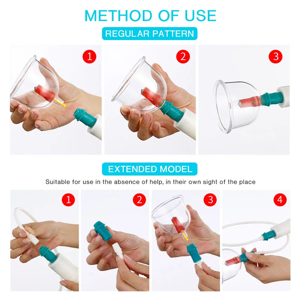 12/20/24 Cans Vacuum Acupuncture Cupping Set – Anti-Cellulite & Physiotherapy Suction Cup Massage Therapy