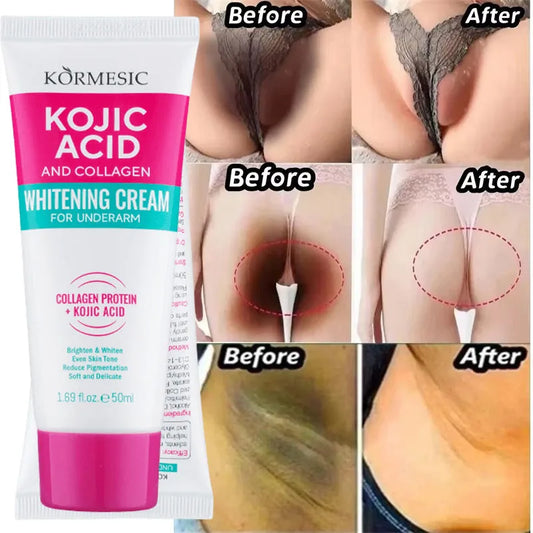 Brightening Body Serum Cream – Underarm, Knee & Inner Thigh Skin Care Moisturizer for Even Tone, Dark Spot Care & Smooth Skin Appearance