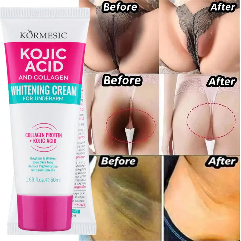 Whitening Cream for Underarms, Knees & Inner Thighs – Brightening Moisturizing Body Serum for Even Skin Tone Care