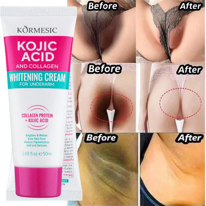 Whitening Cream for Underarms, Knees & Inner Thighs – Brightening Moisturizing Body Serum for Even Skin Tone Care