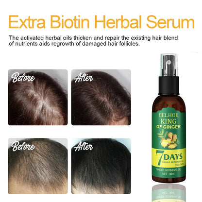Ginger Hair Growth Serum Spray - Nourishing Scalp Treatment for Stronger Roots, Shine & Hair Care