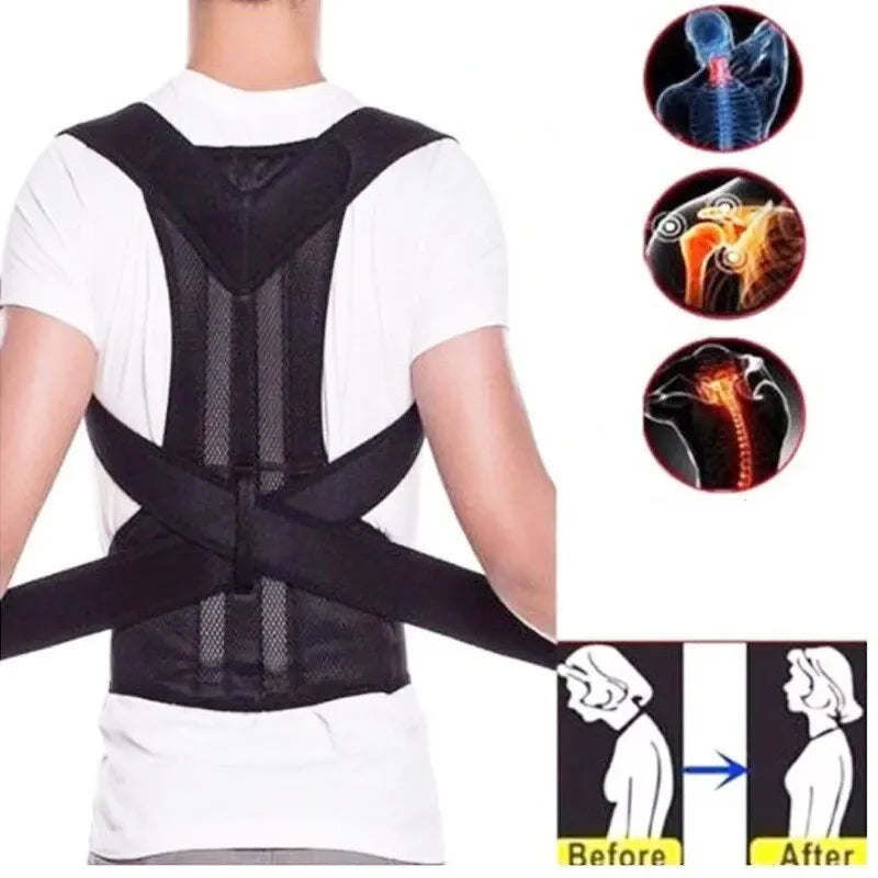 Men’s & Women’s Posture Corrector — Scoliosis & Kyphosis Fix Strap for Students & Adults | Anti-Kyphosis Support