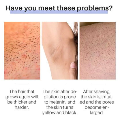 50g Hair Removal Cream - Permanent Hair Growth Inhibitor for Beard, Legs, Body & Armpits - Painless Depilatory Cream