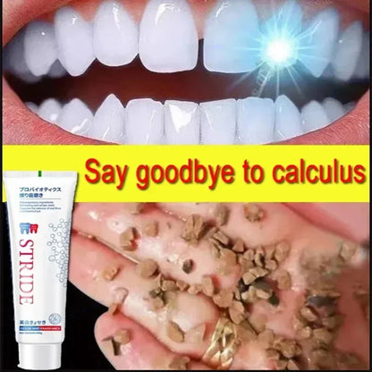 Dental Calculus Remover Toothpaste – Whitening, Bad Breath Removal & Periodontitis Prevention for Teeth Car