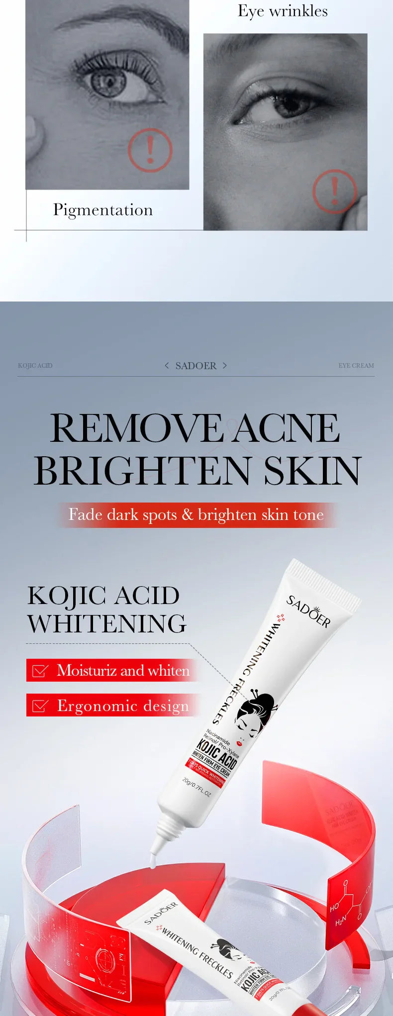 SADOER Kojic Acid Retinol Eye Cream – Anti-Dark Circles, Eye Bag Removal, Moisturizing & Firming Skincare