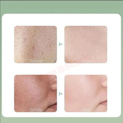 Deep Cleansing Bubble Mask – Hydrating & Purifying Face Mask with Centella Asiatica, Blackhead Removal, Mud Treatment