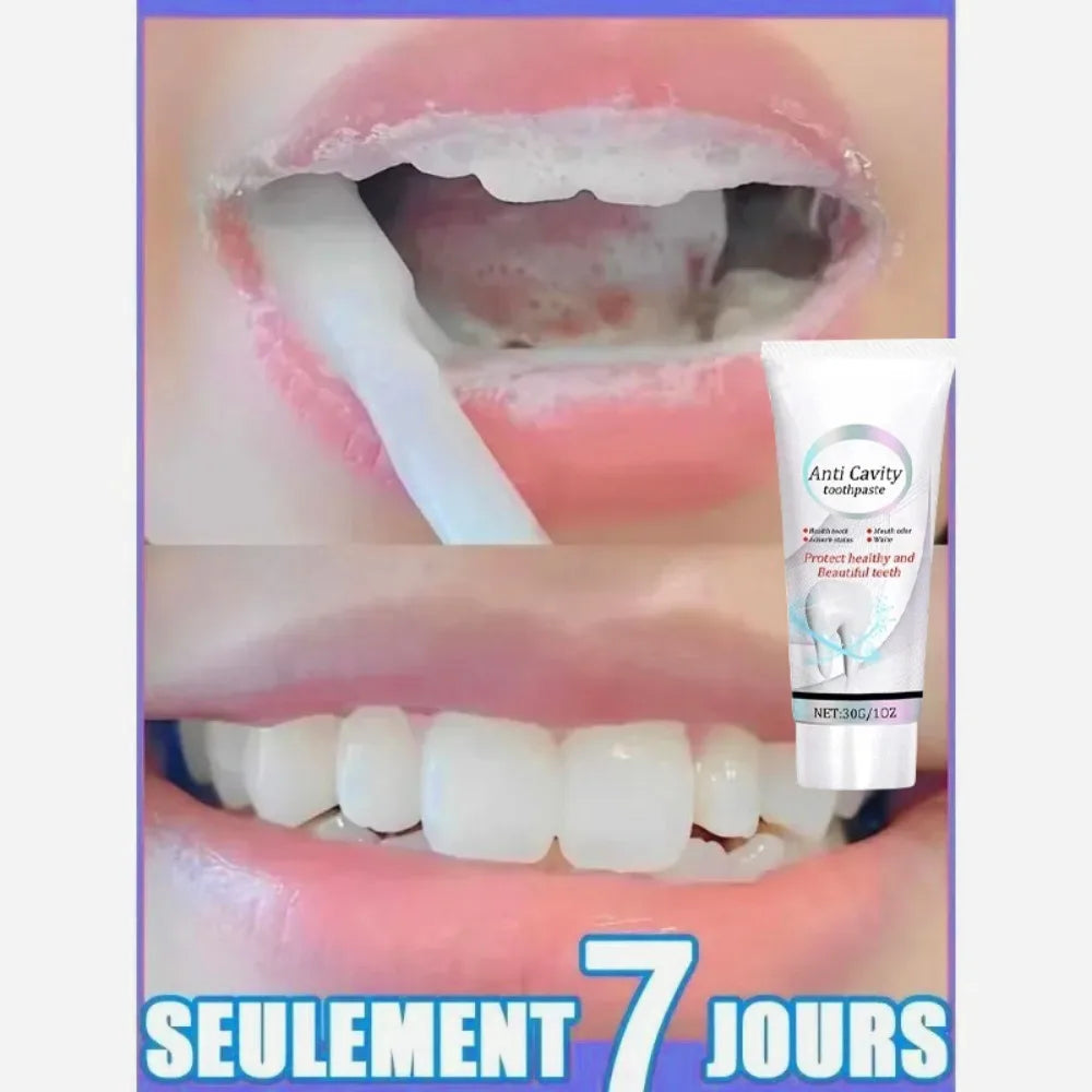 Dental Calculus Remover Toothpaste – Whitening, Bad Breath Removal & Gum Care for Bright Teeth
