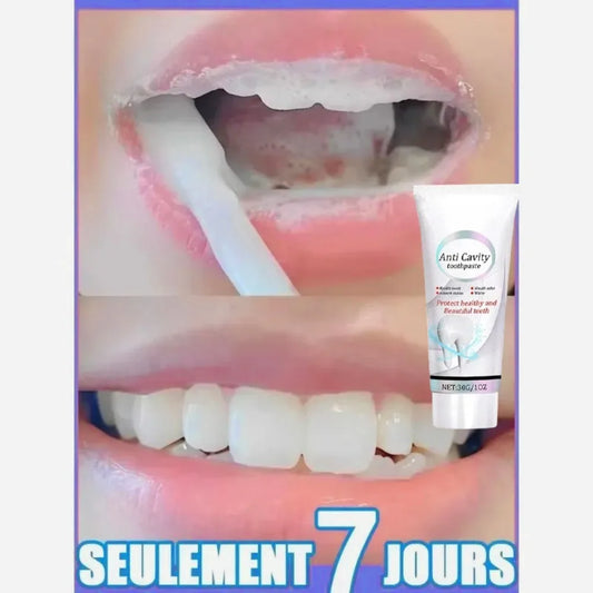 Dental Calculus Remover Toothpaste – Whitening, Bad Breath Removal & Gum Care for Bright Teeth