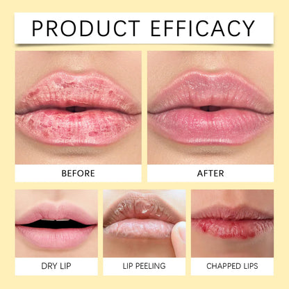Lip Lightening Balm – Melanin Removing Gloss for Exfoliating and Moisturizing