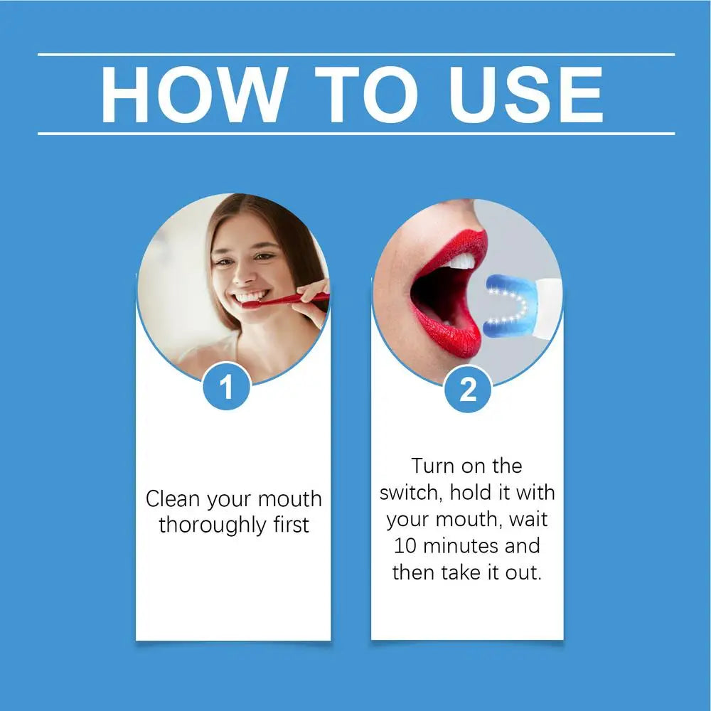 Portable Tooth Cleaning Device – Mild Teeth Cleaner & Stain Remover for Oral Care at Home