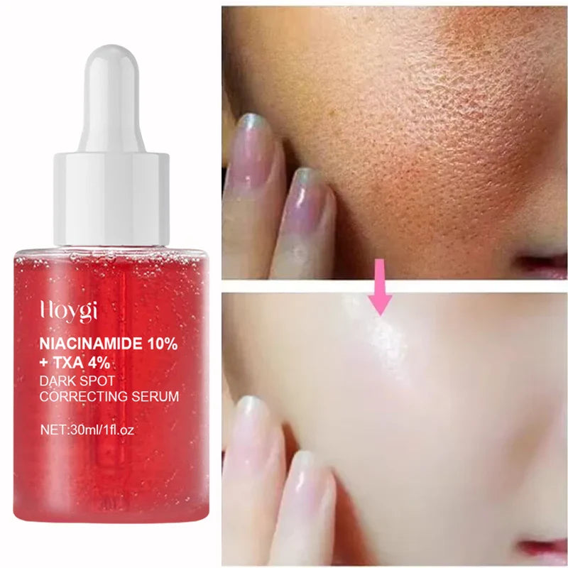 Niacinamide Serum – Dark Spot Correcting, Moisturizing & Brightening, Fades Fine Lines, Deep Cleansing Korean Skincare
